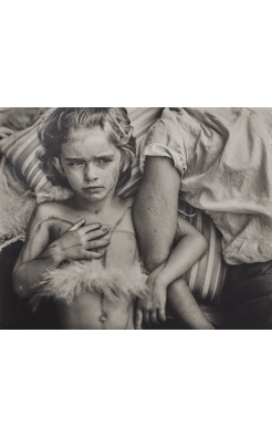 Sally Mann, Jessie Bites, 1985