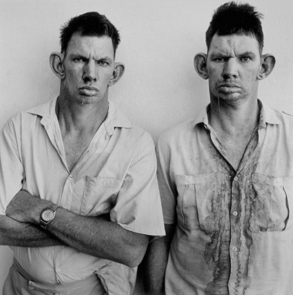 Roger Ballen, Dresie and Casie, Twins, Western Transvaal